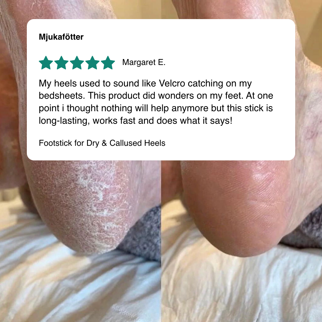 Foot stick for Dry & Callused Heels
